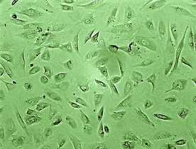                             Egy sejtsorban tenyésztett humán porcsejt kultúra képe invers mikroszkóppal