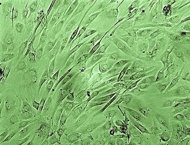                                        Egy sejtsorban tenyésztett birka porcsejt kultúra képe invers mikroszkóppal